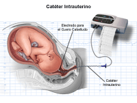 Ilustración del control interno de la frecuencia cardíaca fetal